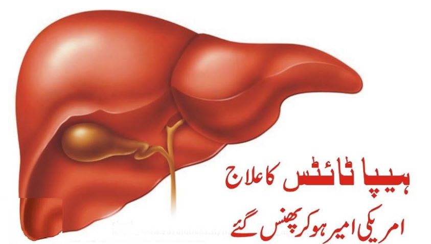 ہیپاٹائٹس قابل علاج لیکن۔۔۔